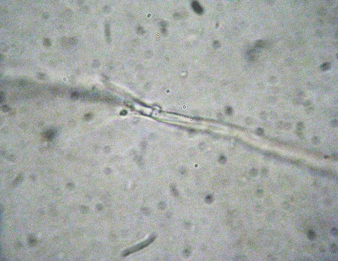 Steccherinum?
